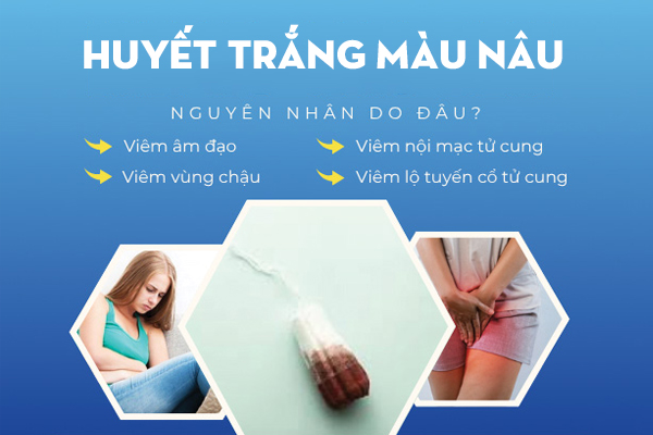 Huyết trắng màu nâu - Biểu hiện sinh lý hay bệnh lý?