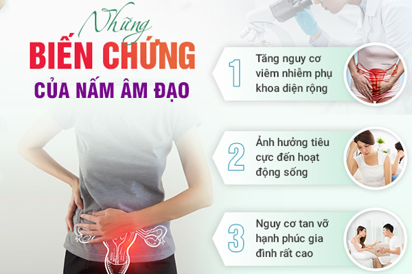 Điều trị nấm âm đạo như thế nào? Địa chỉ khám chữa bệnh hiệu quả