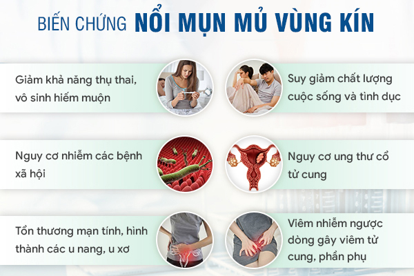 Mụn mủ vùng kín: Nguyên nhân và cách xử lý đúng