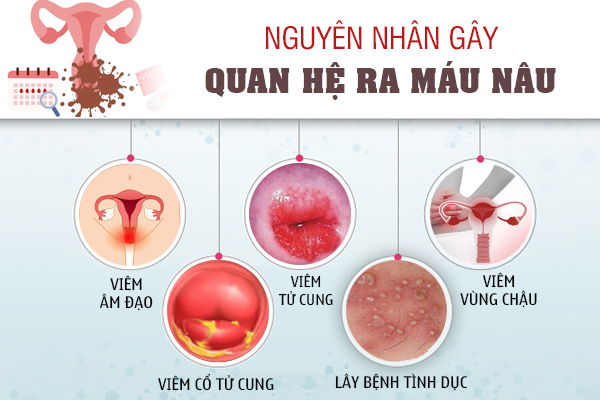 Quan hệ xong ra máu - Dấu hiệu nữ giới không nên xem nhẹ