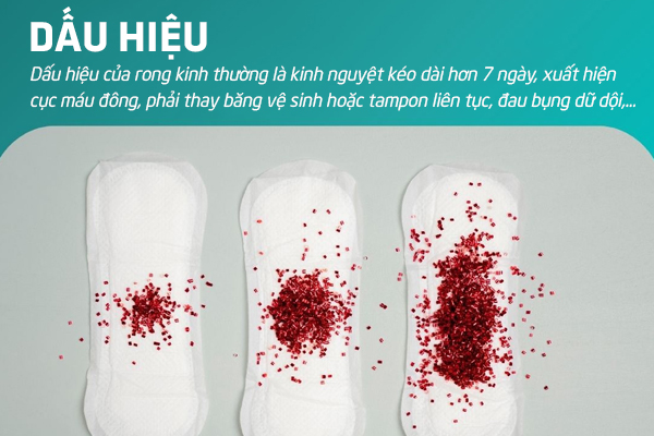 Biện pháp hỗ trợ điều trị rong kinh hiệu quả