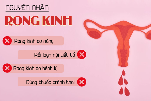 Rong kinh phải làm sao? Bác sĩ chuyên tư vấn chi tiết
