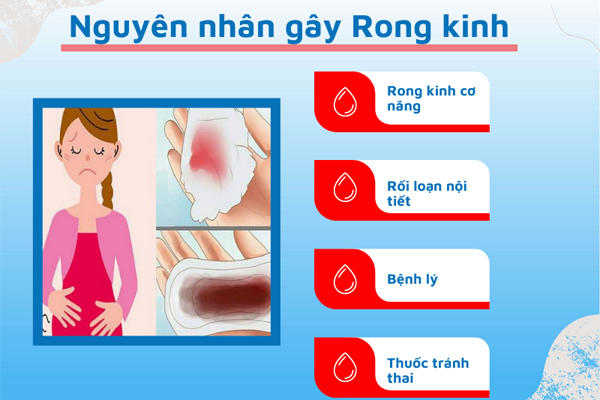 Dấu hiệu rong kinh như thế nào? Cách chữa trị hiệu quả