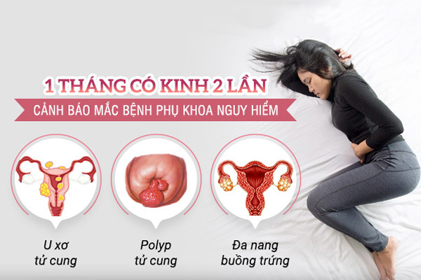 1 tháng có kinh 2 lần - Nguyên nhân và cách điều hòa kinh nguyệt