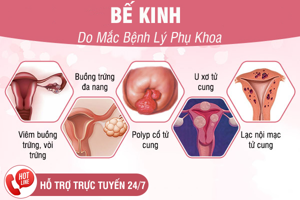 Bế kinh là gì? Nguyên nhân và biện pháp chữa trị hiệu quả