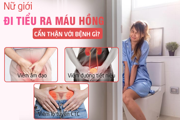 Tiểu ra máu hồng - Nguyên nhân và cách chữa trị hiệu quả