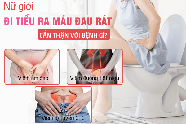 Đi tiểu ra máu đau rát ở nữ cảnh báo bệnh gì?