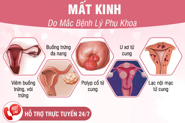 Mất kinh không mang thai - Nguyên nhân là do đâu?