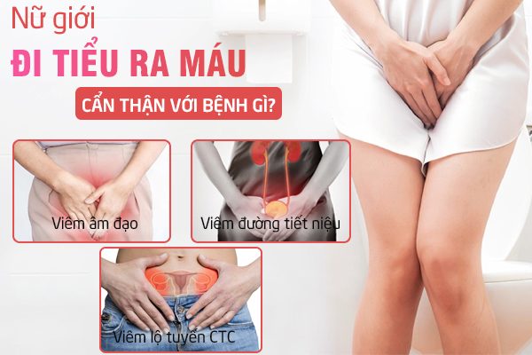 Nước tiểu màu đỏ cảnh báo bệnh gì? Có sao không?