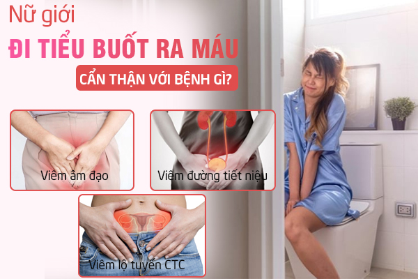 Tiểu buốt ra máu ở nữ - Dấu hiệu không thể xem thường